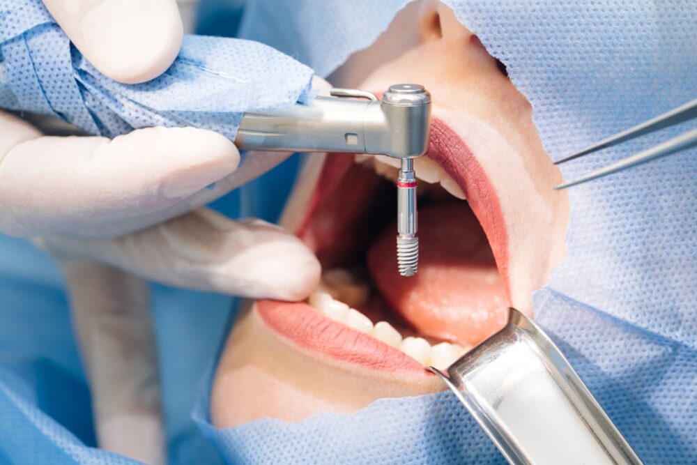 Хирургия и имплантация